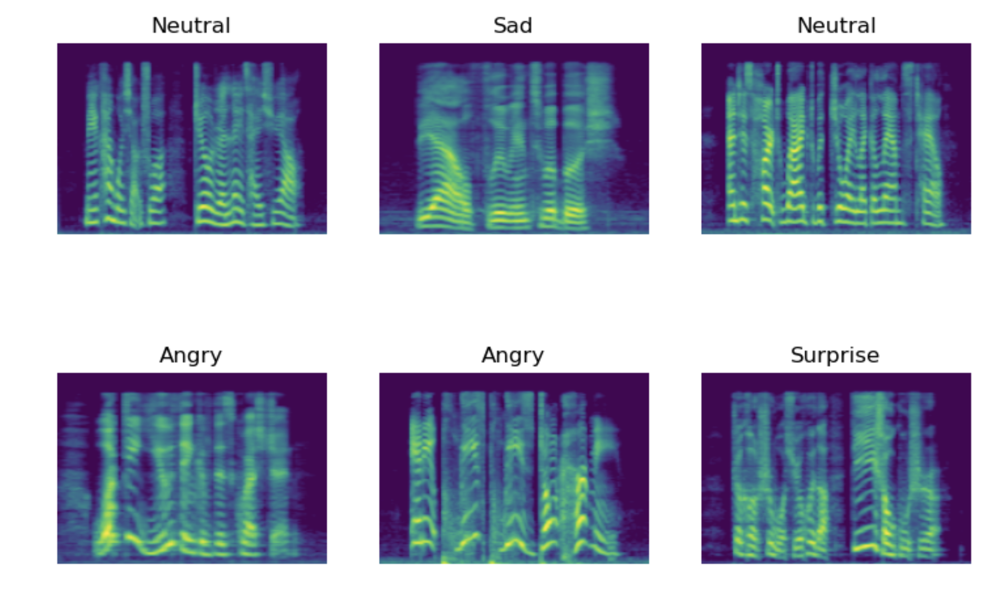 Speech Emotion Recognition